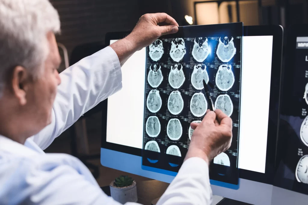 Doctor viewing brain scans. If you’ve suffered a catastrophic injury due to another’s negligence, contact a catastrophic injury attorney today.