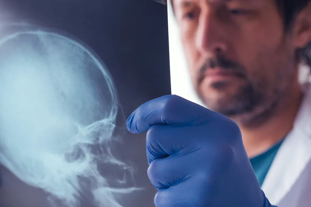 Doctor examining x-ray of the patient's skull. If you've suffered a catastrophic injury due to the negligent acts of another, contact our Kansas City personal injury lawyers now. 